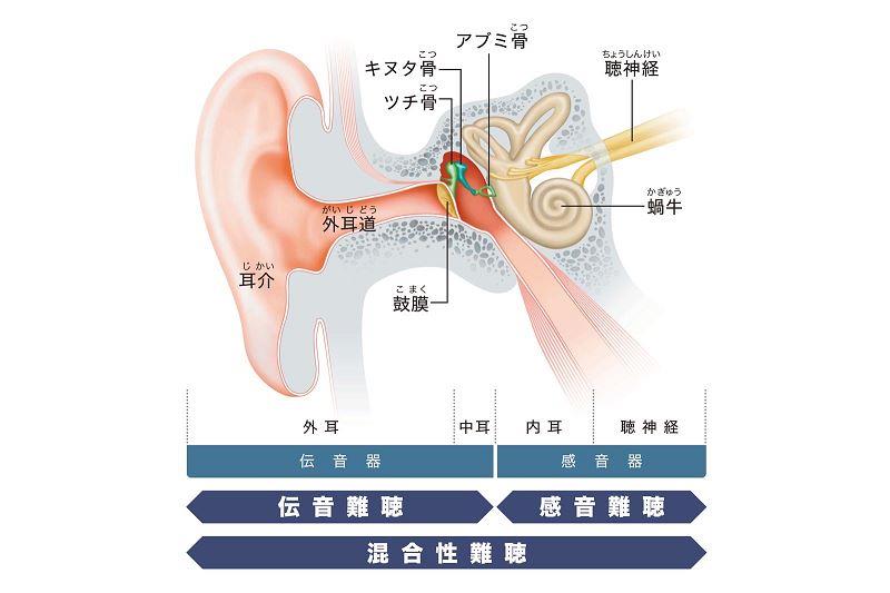 難聴の種類