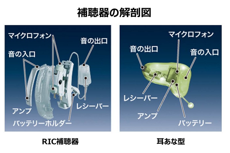 補聴器の仕組み